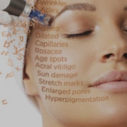 Qu’est-ce que le Microneedling Dp4™?