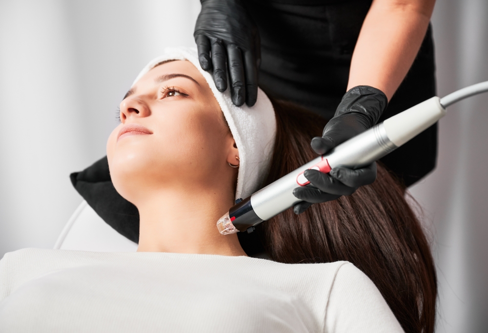 microneedling